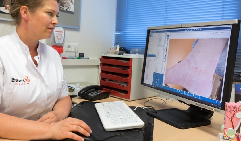 Aan de hand van een foto kan dermatoloog Sarah den Hengst de toestand van de huid goed inschatten.